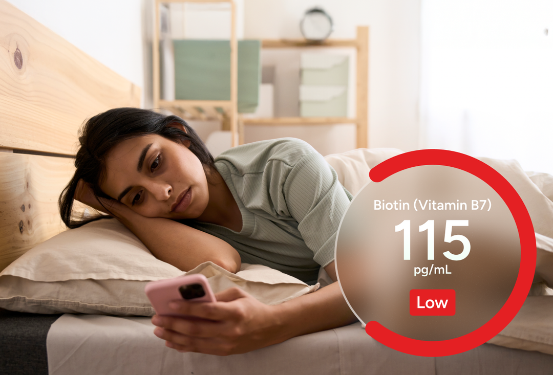 Biotin (Vitamin B7) Test